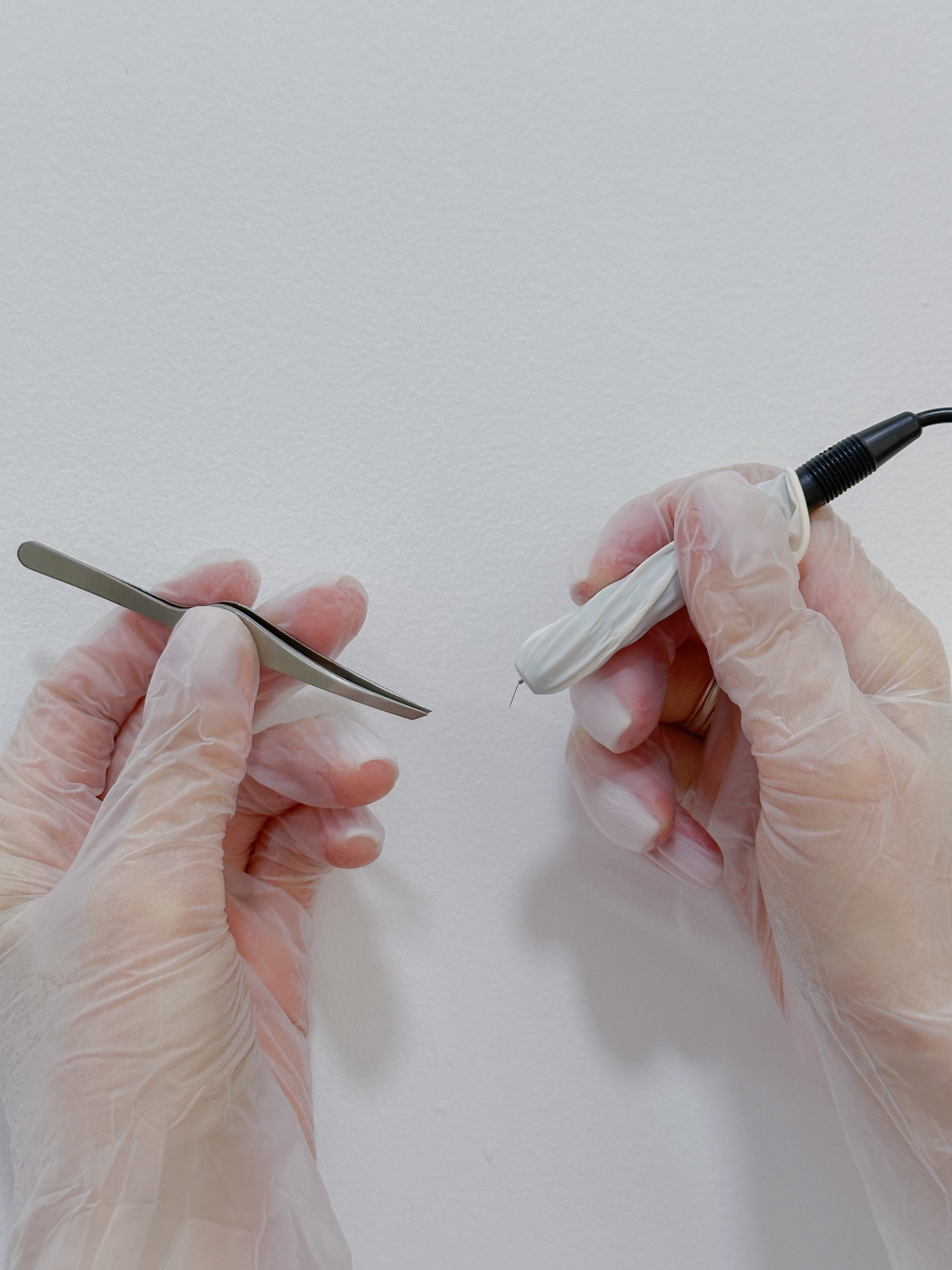 Электроэпиляция всех зон